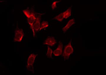Polyclonal Rabbit anti-Human CSE1L Antibody (IF, WB)