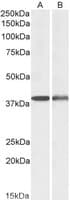 IHC-plus™ CAPG Antibody (aa205-217)