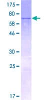 Human KLHDC2 / LCP Protein (Recombinant GST)