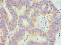 Polyclonal Rabbit anti-Human SPTLC1 / HSN1 Antibody (aa37-310, IHC, WB)