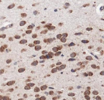 LAMTOR3 / MP1 Antibody