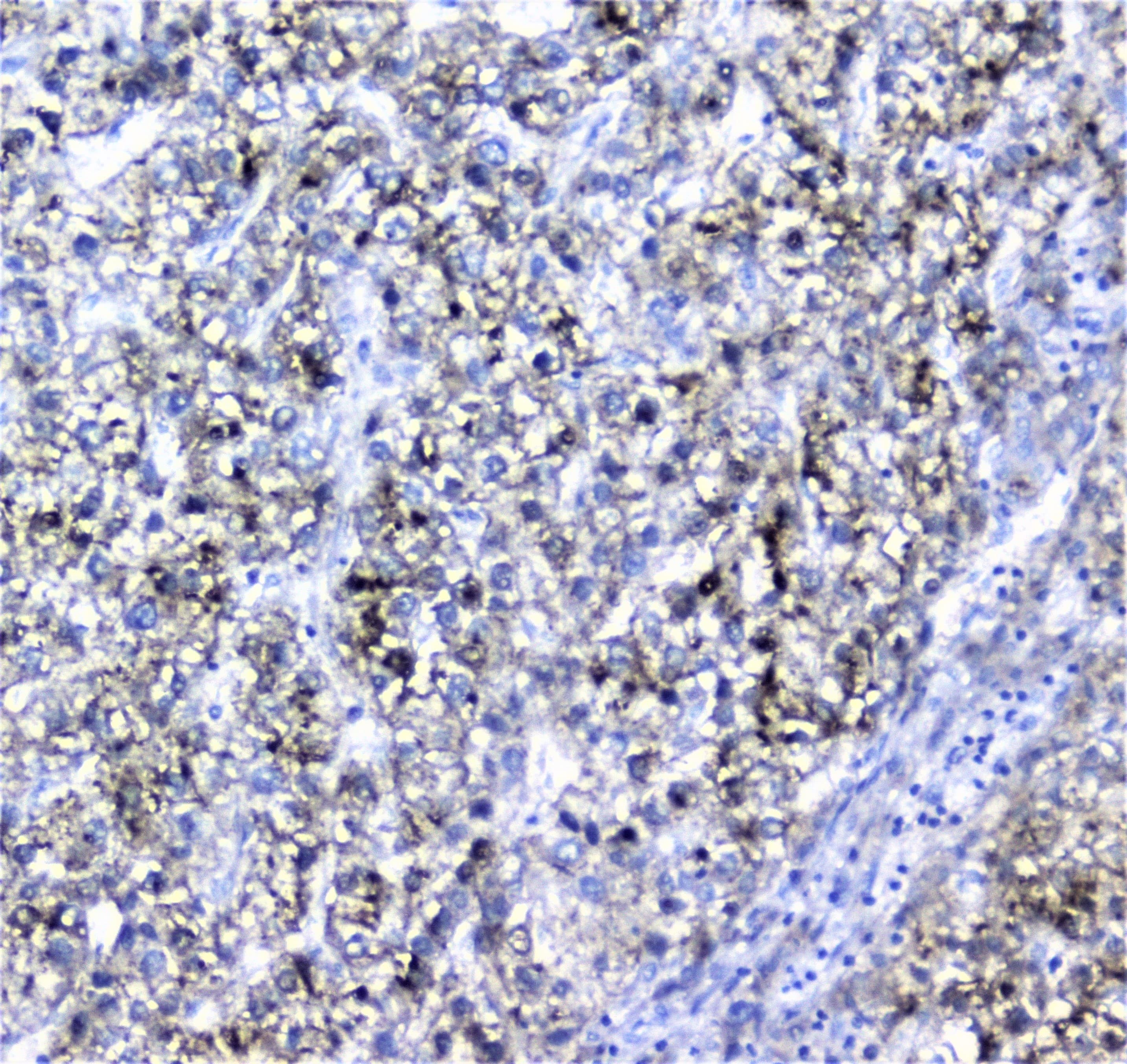 AMBP Antibody