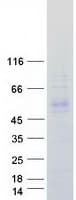 Human KLHDC1 Protein (Recombinant Myc-DDK (Flag))