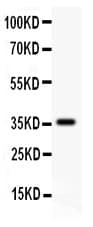 CD82 Antibody (aa98-267)