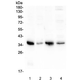 ANXA3 / Annexin A3 Antibody