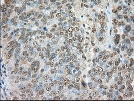 ERIC-1 / TACC3 Antibody (clone OTI6C6)
