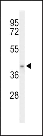 ACAD8 Antibody (aa118-145)