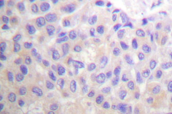Polyclonal Rabbit anti-Human BCAR1 / p130Cas Antibody (Pro160, IHC)