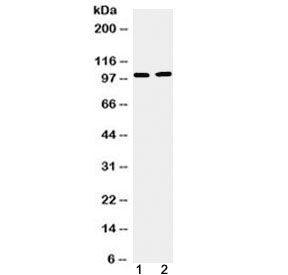 TACC1 Antibody