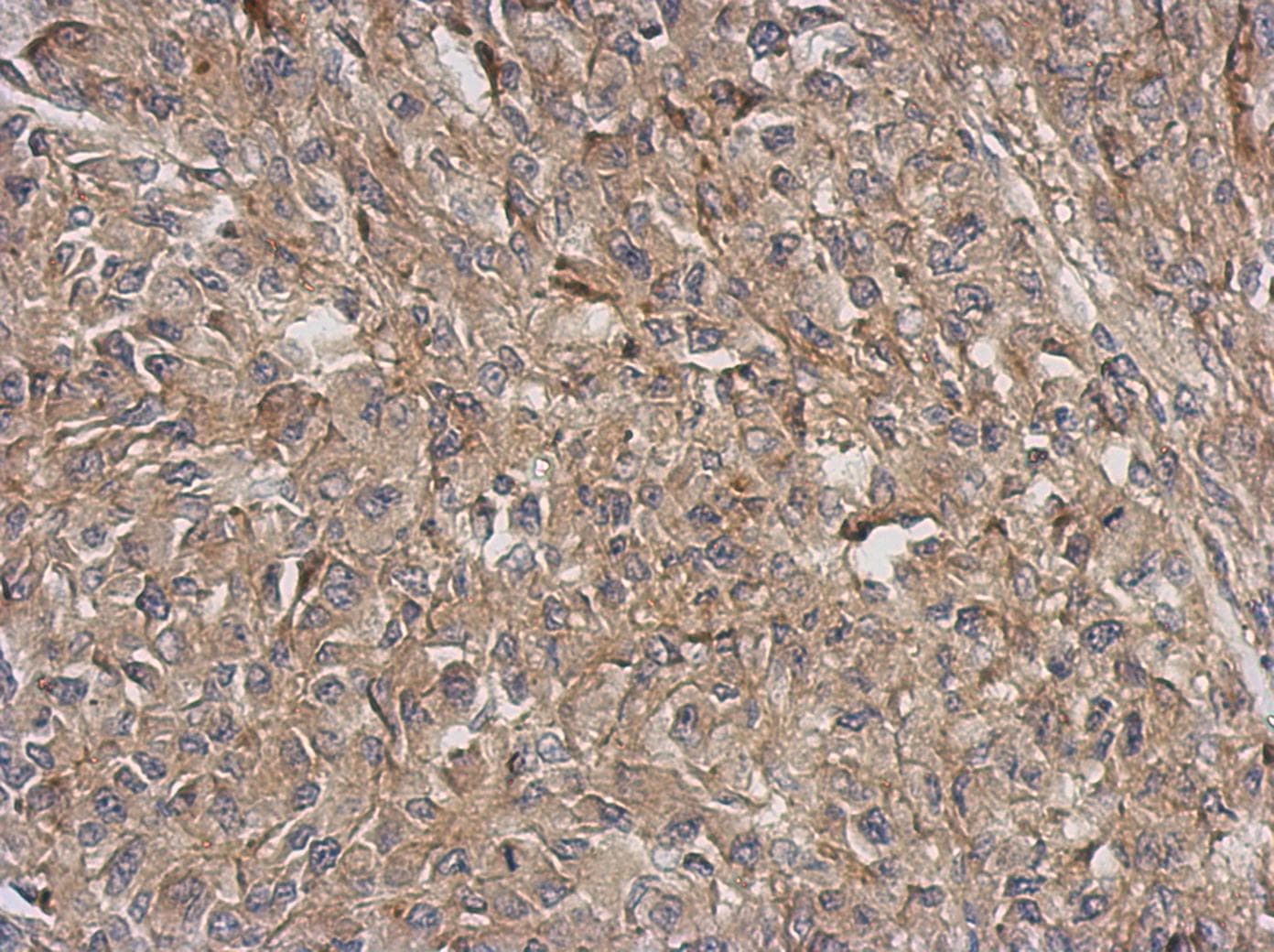 Polyclonal Rabbit anti-Human ARPC5L Antibody (IHC, WB)