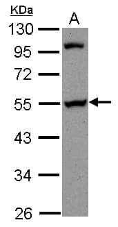 Polyclonal Rabbit anti-Human PAIP1 Antibody (WB)