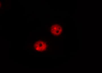 RB1 / Retinoblastoma / RB Antibody (phospho-Ser807)