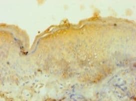 Tyrosinase Antibody (aa19-377)
