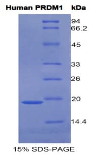 Human BLIMP1 / PRDM1 Protein (Recombinant His, N-Terminal)