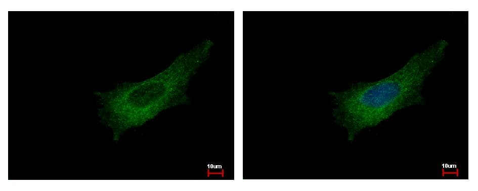Polyclonal Rabbit anti-Human PLEK / Pleckstrin Antibody (aa287-300, WB)