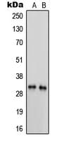 PRSS3 / Trypsin 3 Antibody (Internal)