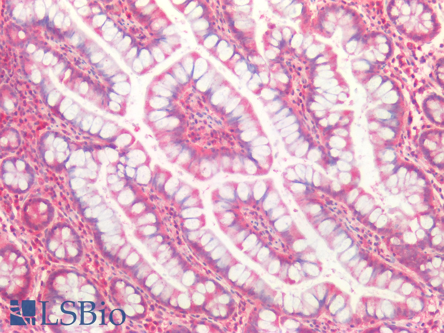 PathPlus™ CASP10 / Caspase 10 Antibody
