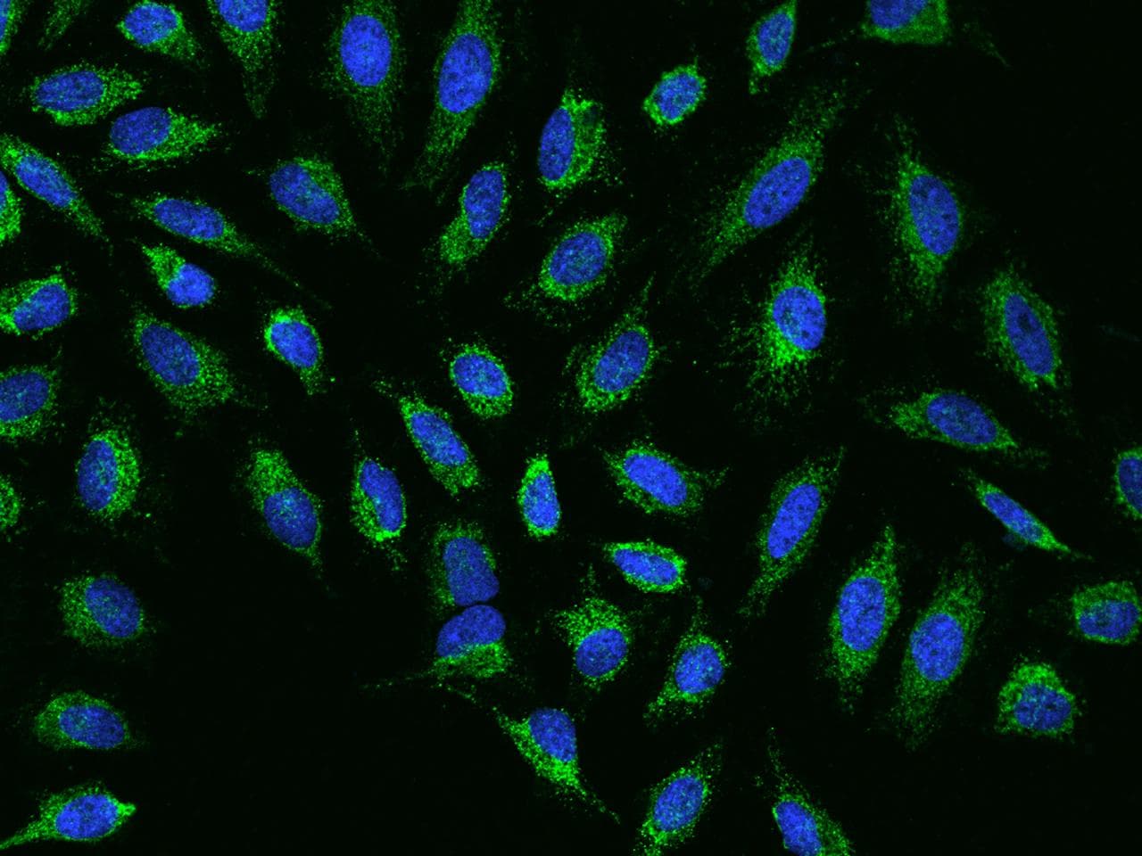 NDUFB7 / B18 Antibody
