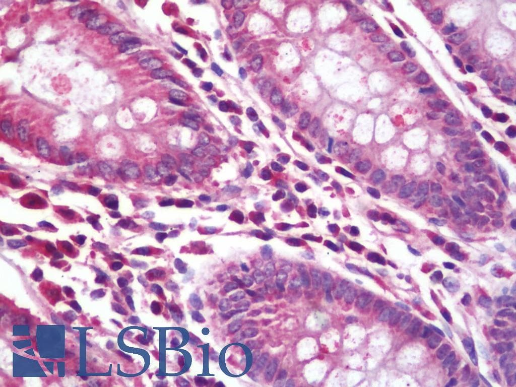 RPL5 / Ribosomal Protein L5 Antibody (HRP)