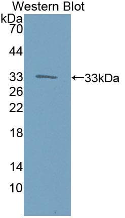 KTN1 / Kinectin Antibody (aa1104-1357)