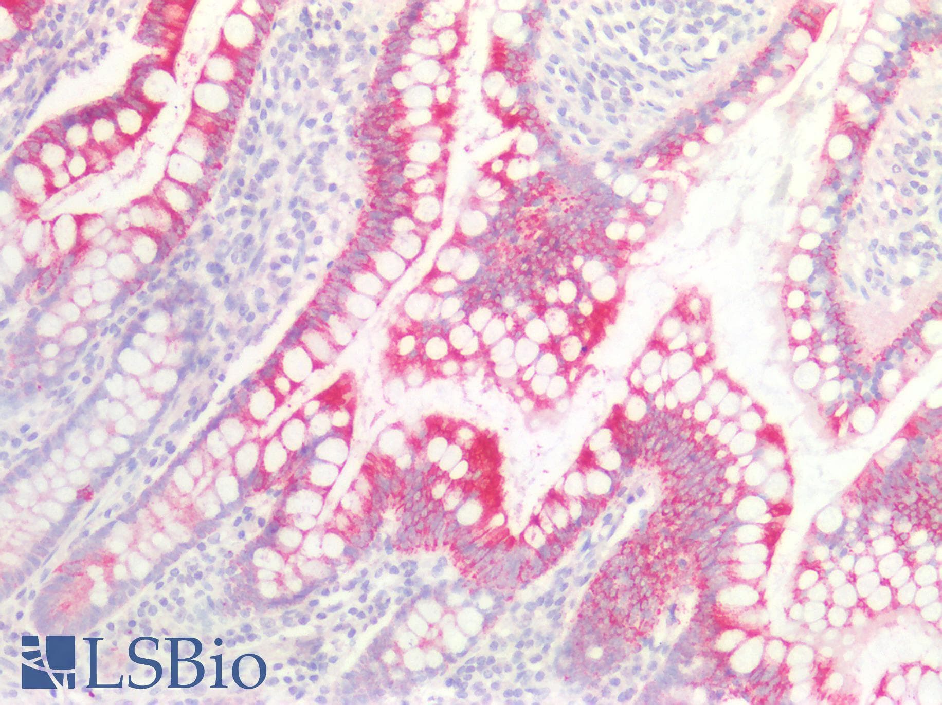 PathPlus™ Polyclonal Rabbit anti-Human FOLR1 / Folate Receptor Alpha Antibody (IHC)