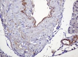 PARVB Antibody (clone OTI1B7)