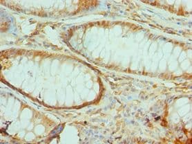 TIRAP Antibody (aa1-221)