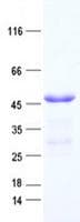Human MGC11296 / BRMS1L Protein (Recombinant His, N-Terminal)