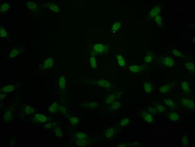 Polyclonal Rabbit anti-Human HIST1H2AI Antibody (IF)