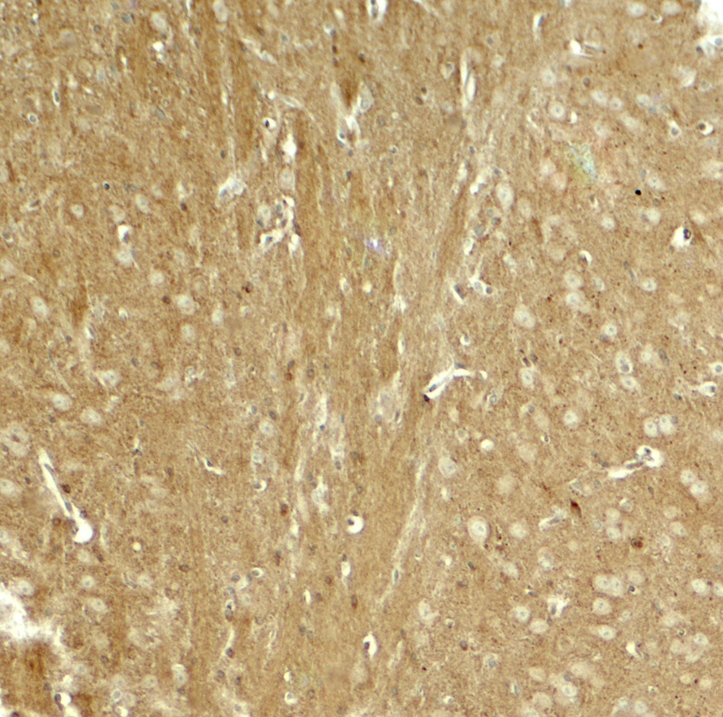 IHC-plus™ Polyclonal Rabbit anti-Human MAPT / Tau Antibody (IHC, WB)
