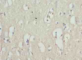 Polyclonal Rabbit anti-Human C8orf51 Antibody (IHC)