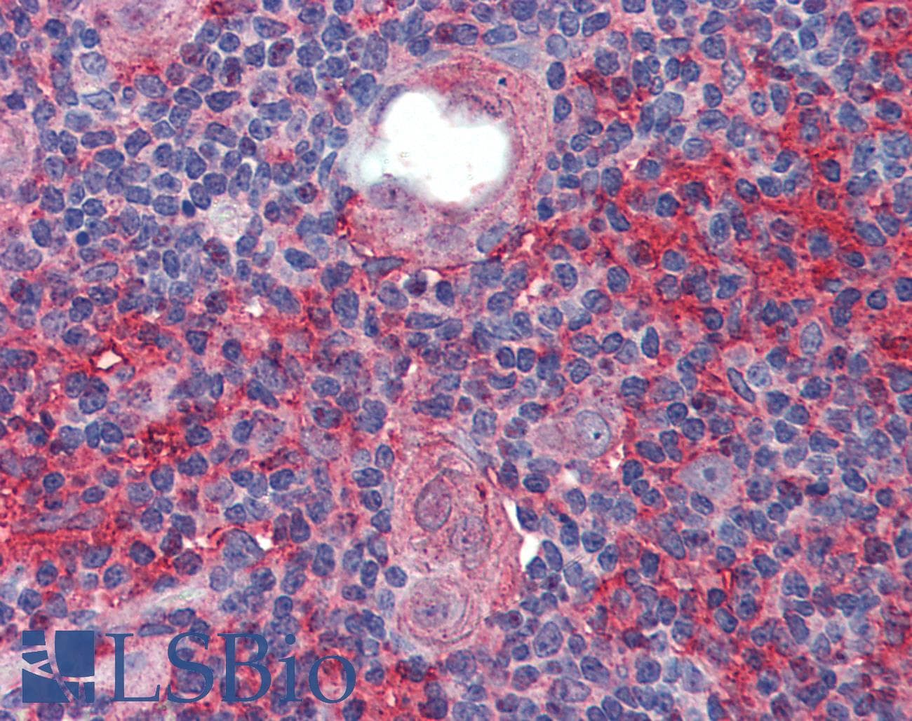 PathPlus™ IGSF4C / CADM4 Antibody (aa73-83)