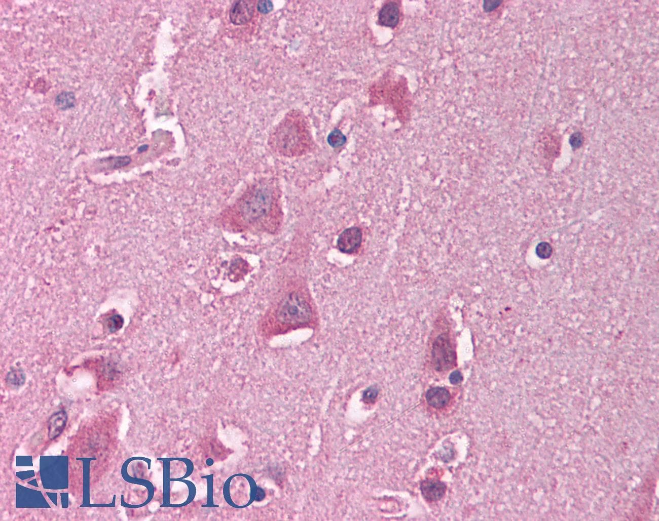 Polyclonal Rabbit anti-Human HSF1 Antibody (C-Terminus, IHC, WB)