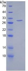 Human HSPG2 / Perlecan Protein (Recombinant His, N-Terminal)