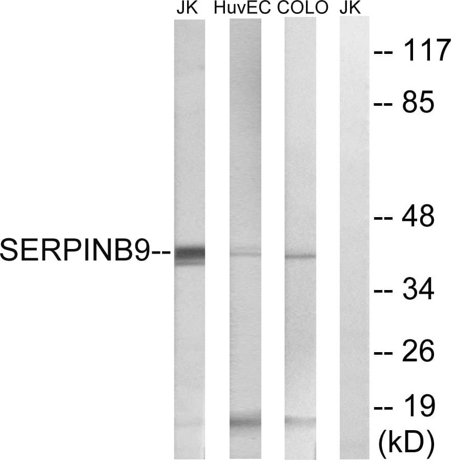 Polyclonal Rabbit anti-Human SERPINB9 / PI9 Antibody (aa241-290, IHC, WB)