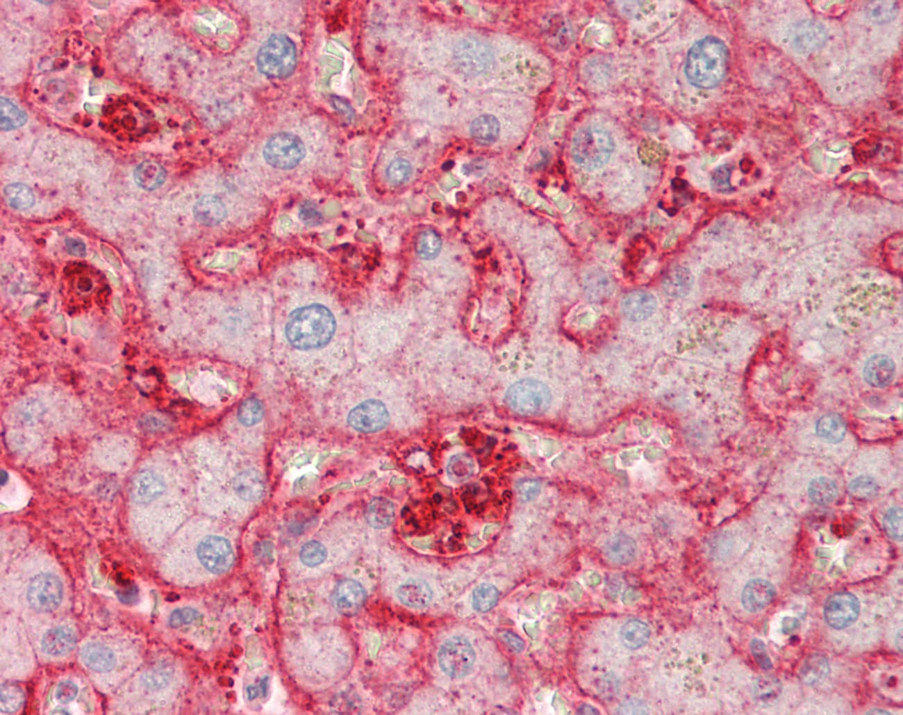 Polyclonal Rabbit anti-Human STOM / Stomatin Antibody (aa203-252, IHC, IF, WB)