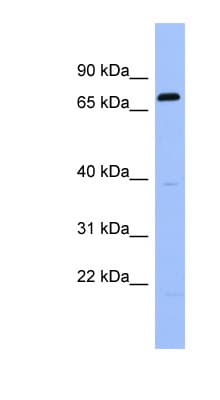 RGS9 Antibody (C-Terminus)