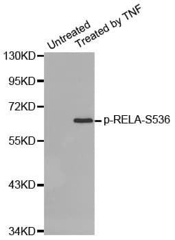 RELA / NFKB p65 Antibody (phospho-Ser536)