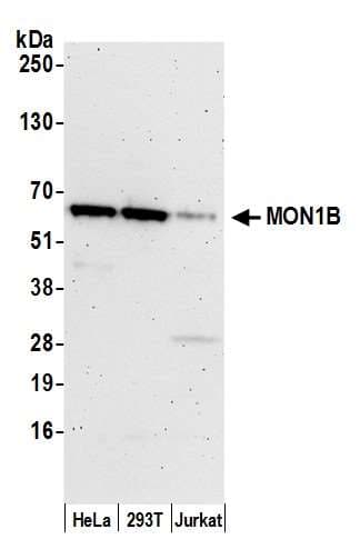 Polyclonal Rabbit anti-Human MON1B Antibody (aa25-75, WB)