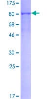 Human p56lck / LCK Protein (Recombinant GST)