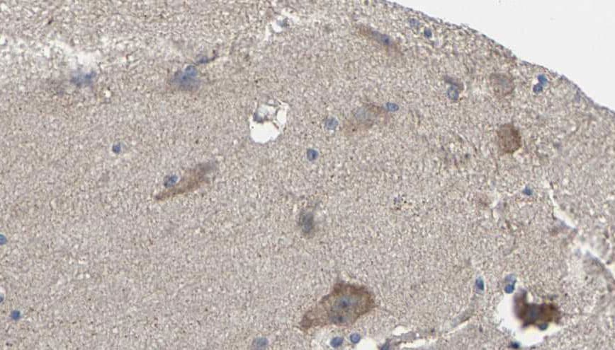 CNR1 / CB1 Antibody