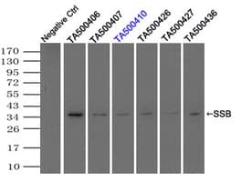 SSB / La Antibody (clone OTI3H9)