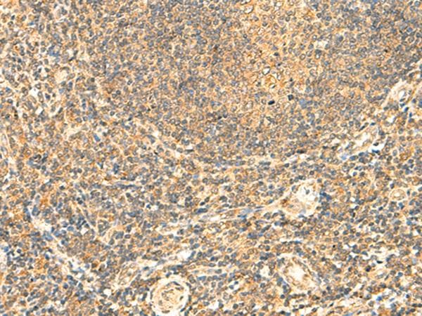 Polyclonal Rabbit anti-Human LYZL1 Antibody (IHC)