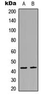 RIMKLB Antibody (Internal)