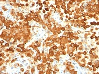 PMEL / SILV / gp100 Antibody (clone HMB45 + PMEL/783, Ready-to-Use)