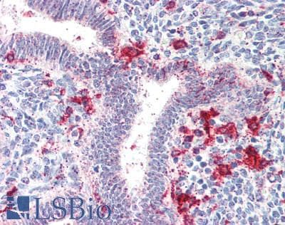 IHC-plus™ Polyclonal Rabbit anti-Human HLA-DRB4 Antibody (IHC, WB)