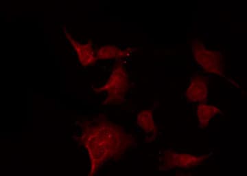 CASP3 / Caspase 3 Antibody (phospho-Ser150)