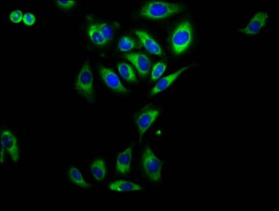 Polyclonal Rabbit anti-Human RAMP2 Antibody (IHC, IF)
