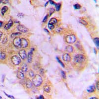 IKBKG / NEMO / IKK Gamma Antibody (Internal)