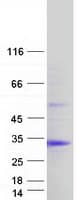 Human CHAC1 / MGC4504 Protein (Recombinant Myc-DDK (Flag))